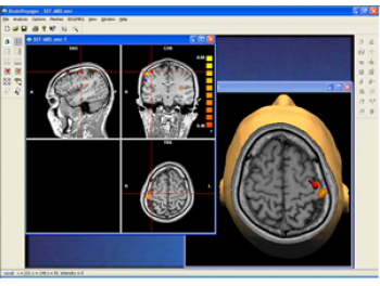 脳画像の処理を行う専門的なソフトウェア